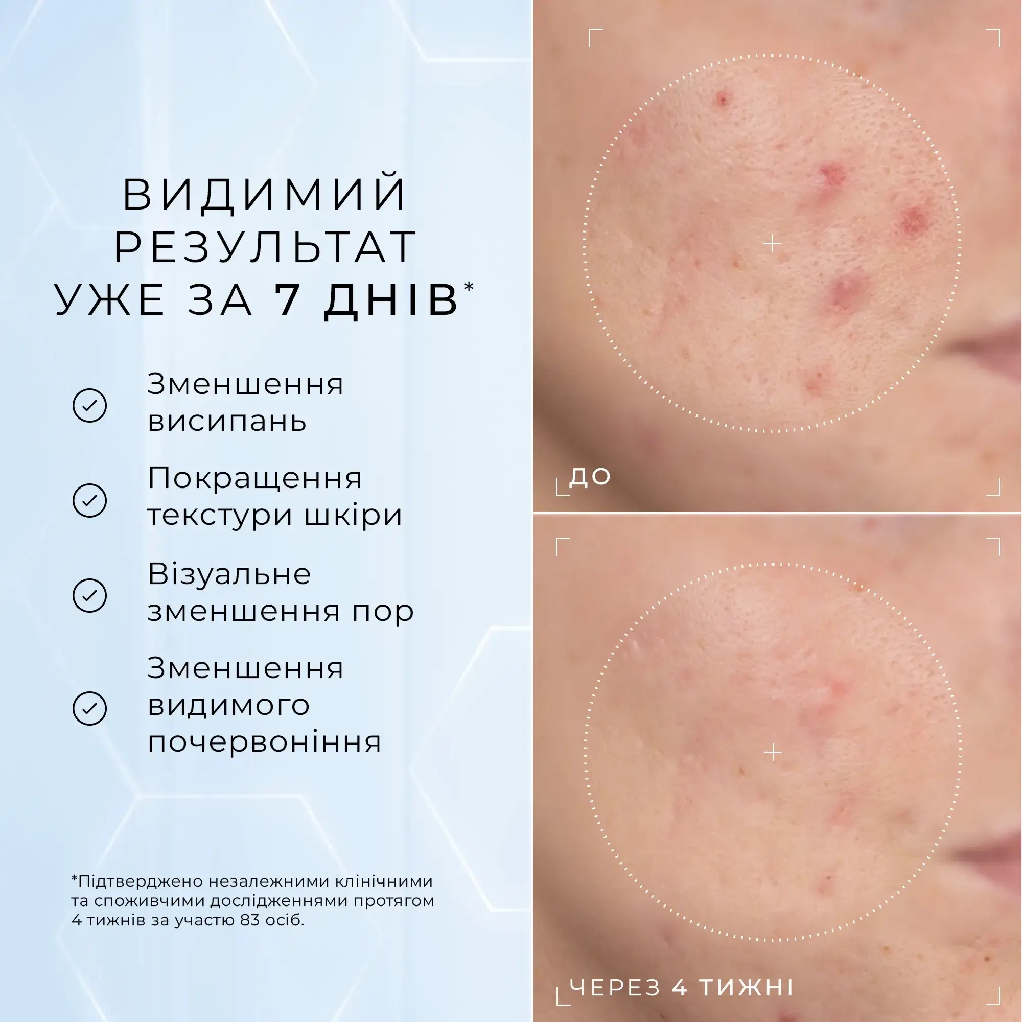 Medik8 Niacinamide Peptides – Пептидна сироватка з ніацинамідом